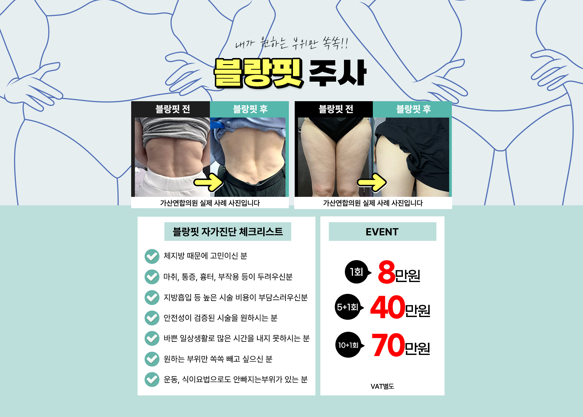 블랑핏주사